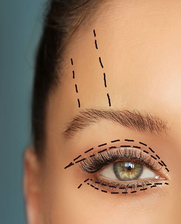 Lower and upper Blepharoplasty.Marking the face.Perforation lines on females face, plastic surgery concept.