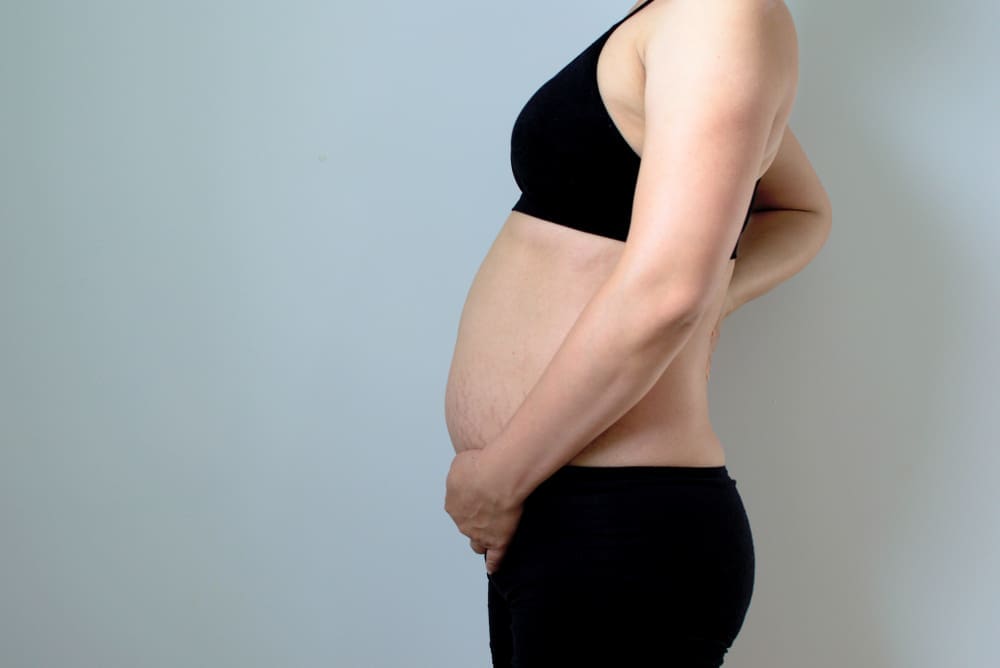 Good Candidates for a Mommy Makeover Good Candidates for a Mommy Makeover