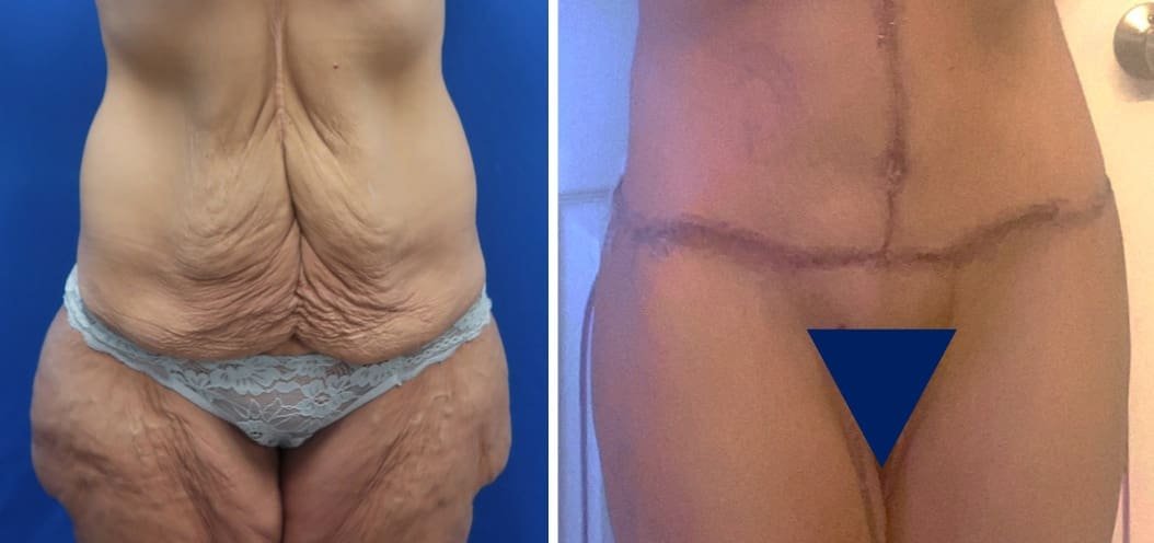 Screenshot 2023-09-11 at 9.18.49 AM