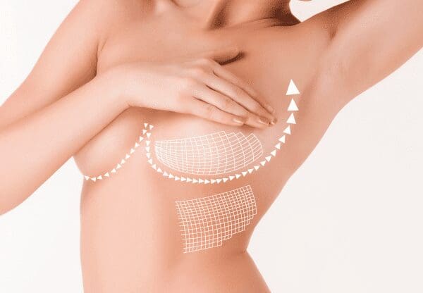 Galaflex “Internal Bra” Breast Suspension