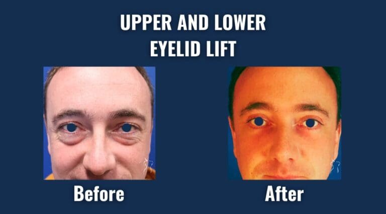 Copy of Before and After Photos